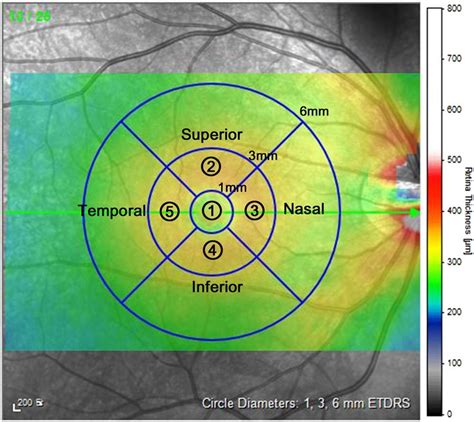 thickness measurement of retinal layers|average retinal thickness.